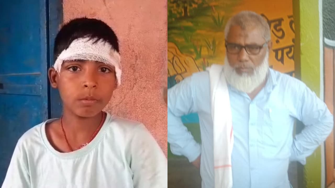 प्रार्थना में 2 मिनट देर से पहुंचा छात्र, प्रिंसिपल ने की ऐसी पिटाई कि बच्चे का फटा सिर